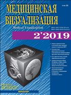 Медицинская визуализация №2 2019